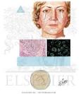 <b>Sjogren's Syndrome</b>