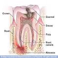 Dental Enamel, Dental Pulp, irreversible pulpitis, reversible pulpitis, root canal, tooth abscess, Tempe Dentist