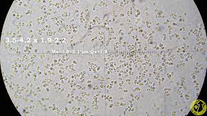 Attēlu rezultāti vaicājumam “Ceriporia excelsa”