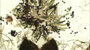 Attēlu rezultāti vaicājumam “Sordaria fimicola”