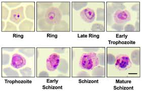 Attēlu rezultāti vaicājumam “Physarum nitens plasmodium”