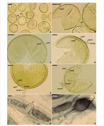 Attēlu rezultāti vaicājumam “Enteridium variabile spores”