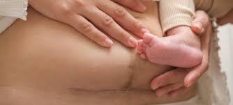 Image result for cesarskie