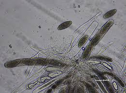 Attēlu rezultāti vaicājumam “Pertusaria leioplaca”