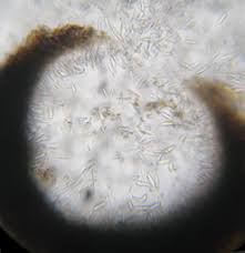 Attēlu rezultāti vaicājumam “Lecanactis abietina”