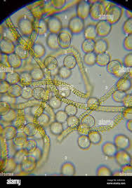 Attēlu rezultāti vaicājumam “Arcyria globosa”