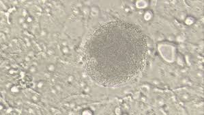 Attēlu rezultāti vaicājumam “Physarum nitens plasmodium”