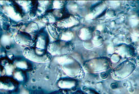 Attēlu rezultāti vaicājumam “Lycogala botrydium spores”