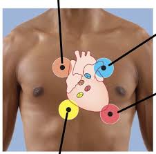 Image result for Autopheresis C