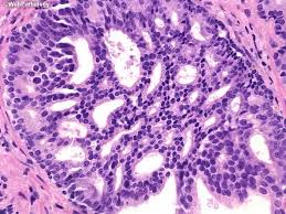 Attēlu rezultāti vaicājumam “Cribraria piriformis young”