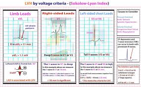 Image result for  ^ L V [ h    