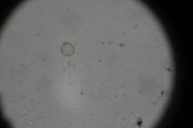 Attēlu rezultāti vaicājumam “Cribraria rubiginosa”