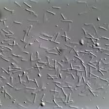 Attēlu rezultāti vaicājumam “Rhytisma acerinum”