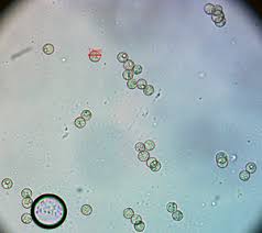 Attēlu rezultāti vaicājumam “Heterotrichia ferruginea (syn. Arcyria ferruginea) macro”