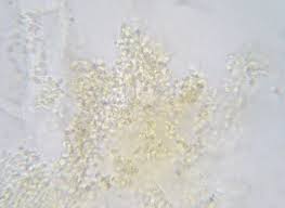 Attēlu rezultāti vaicājumam “Puccinia urticata”