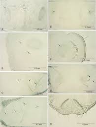 Attēlu rezultāti vaicājumam “Tischeria complanella larva”