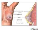 http://health.yahoo.net/images/adam/big/1075.jpg