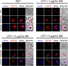 Attēlu rezultāti vaicājumam “Enteridium variabile plasmodium”