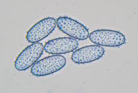 Attēlu rezultāti vaicājumam “Peziza flavida”