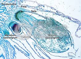 Attēlu rezultāti vaicājumam “Jungermannia sphaerocarpa sporophyte”