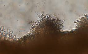 Attēlu rezultāti vaicājumam “Dianema nivale spores”