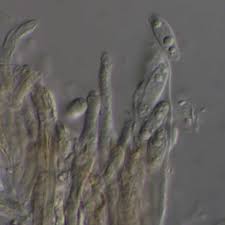 Attēlu rezultāti vaicājumam “Hymenoscyphus sp.”