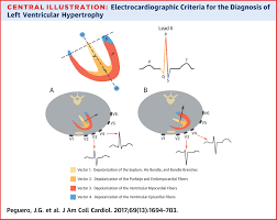 Image result for  ^ L V [ h    
