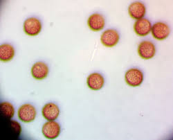 Attēlu rezultāti vaicājumam “Diderma deplanatum sessile”