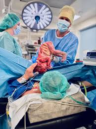 Image result for cesarskie