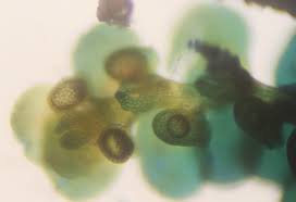 Attēlu rezultāti vaicājumam “Jungermanniopsida”