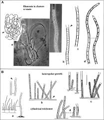 Attēlu rezultāti vaicājumam “Nostoc pruniforme macro”