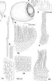Attēlu rezultāti vaicājumam “Polytrichastrum pallidisetum cells”