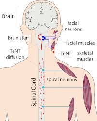 Attēlu rezultāti vaicājumam “Tetanops myopina”
