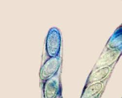 Attēlu rezultāti vaicājumam “Fuligo leviderma macro”