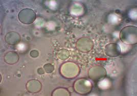 Attēlu rezultāti vaicājumam “Badhamiopsis ainoae spores”
