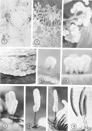 Attēlu rezultāti vaicājumam “Stemonitis virginiensis spores”