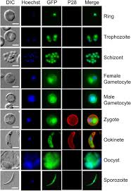 Attēlu rezultāti vaicājumam “Diachea muscorum plasmodium”