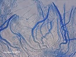 Attēlu rezultāti vaicājumam “Stictis”