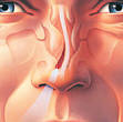 Cosmetic and Deviated Septum Surgery Combinations | Deviated ...