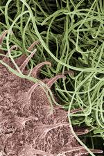 Attēlu rezultāti vaicājumam “Galium schultesii fruit”