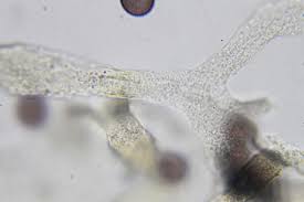 Attēlu rezultāti vaicājumam “Badhamiopsis ainoae macro”