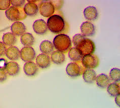 Attēlu rezultāti vaicājumam “Tranzschelia pruni-spinosae spores”