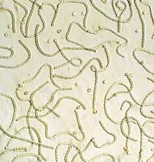 Attēlu rezultāti vaicājumam “Nostoc commune cells”