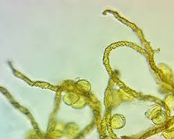 Attēlu rezultāti vaicājumam “Trichia contorta macro”