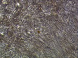 Attēlu rezultāti vaicājumam “Biatora sphaeroides”