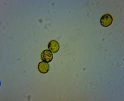 Attēlu rezultāti vaicājumam “Trichia varia spores”