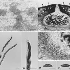 Attēlu rezultāti vaicājumam “Didymium annulisporum sessile”