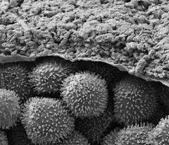 Attēlu rezultāti vaicājumam “Amaurochaete fusiformis spores”