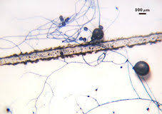 Attēlu rezultāti vaicājumam “Enteridium liceoides spores”