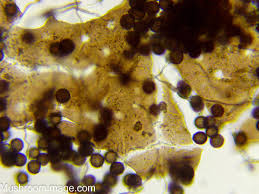 Attēlu rezultāti vaicājumam “Didymium megalosporum”